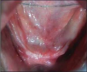 http://www.jdrntruhs.org/articles/2013/2/4/images/JNTRUnivHealthSci_2013_2_4_292_122177_f2.jpg