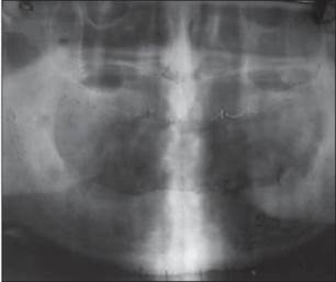 http://www.jdrntruhs.org/articles/2013/2/4/images/JNTRUnivHealthSci_2013_2_4_292_122177_f3.jpg
