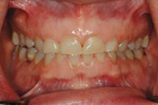 https://www.dentistrytoday.com/Media/EditLiveJava/1111_Engelberg_03.jpg