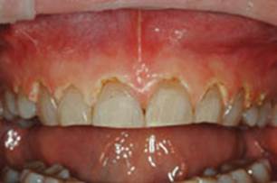https://www.dentistrytoday.com/Media/EditLiveJava/1111_Engelberg_04.jpg