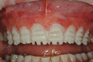 https://www.dentistrytoday.com/Media/EditLiveJava/1111_Engelberg_05.jpg