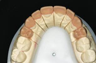 https://www.dentistrytoday.com/Media/EditLiveJava/1111_Engelberg_12.jpg