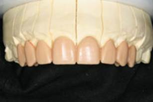 https://www.dentistrytoday.com/Media/EditLiveJava/1111_Engelberg_11.jpg