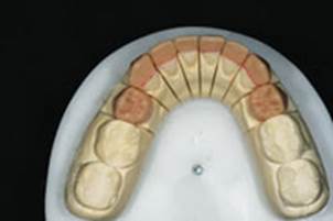 https://www.dentistrytoday.com/Media/EditLiveJava/1111_Engelberg_14.jpg