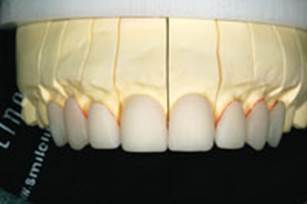 https://www.dentistrytoday.com/Media/EditLiveJava/1111_Engelberg_15.jpg