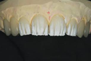 https://www.dentistrytoday.com/Media/EditLiveJava/1111_Engelberg_16.jpg