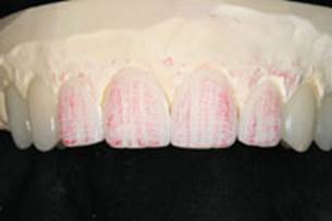 https://www.dentistrytoday.com/Media/EditLiveJava/1111_Engelberg_21.jpg