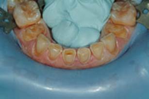 https://www.dentistrytoday.com/Media/EditLiveJava/1111_Engelberg_26.jpg