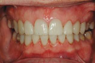 https://www.dentistrytoday.com/Media/EditLiveJava/1111_Engelberg_28.jpg